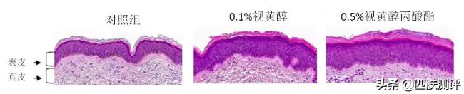 olay超a瓶和hbn哪个好,olay超a瓶真的好用吗