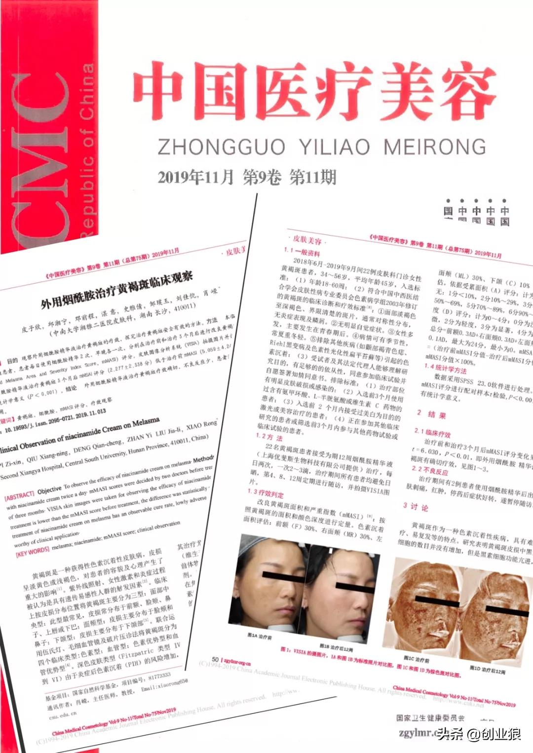 修正烟酰胺精华液祛斑效果,优斐斯淡斑烟酰胺