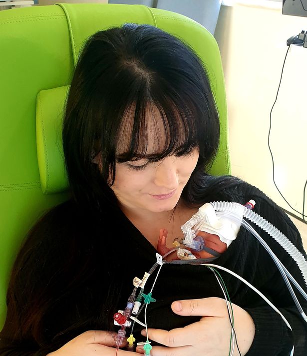 英国孕妇怀孕三胞胎,美国妈妈怀孕羊水破了