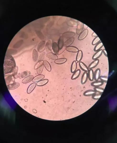 孩子屁股痒怎样快速止痒,女童屁痒用啥药处理