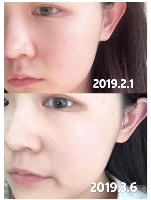 日本这个赛过美白针的王牌内服，让贵妇POLA、SK-II靠边站！