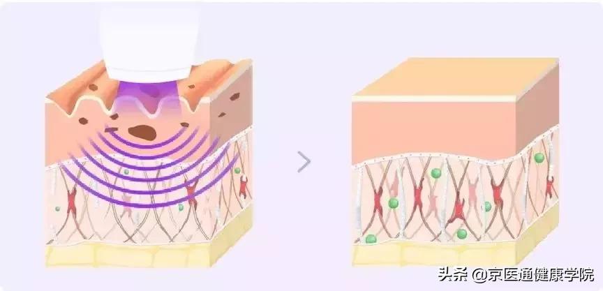 胶原蛋白真的有必要买吗,新手一定要知道的胶原蛋白骗局