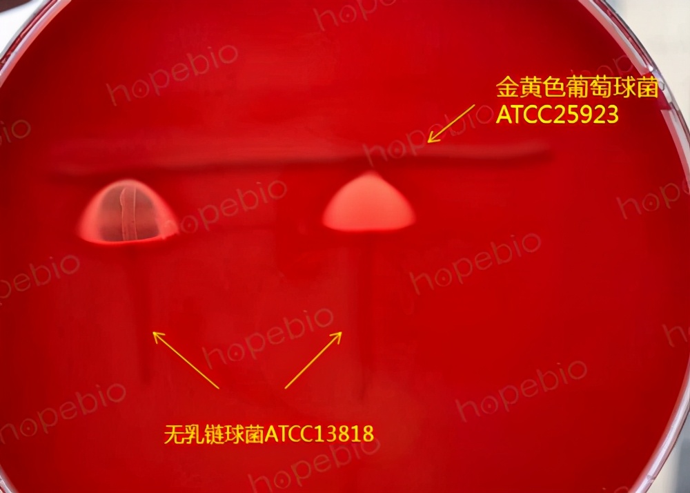 细菌溶血实验步骤,细菌革兰染色实验报告