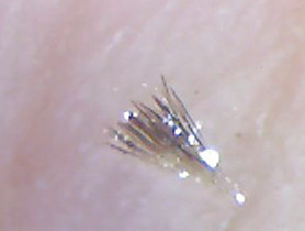 别折腾了，你这样去黑头是没有用的！