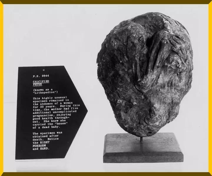 赵丽颖产子后现状,赵丽颖哪年产子