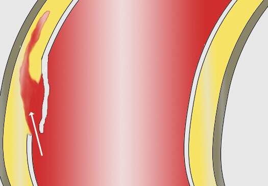 d-二聚体测定正常吗,颠覆认知免费阅读全文