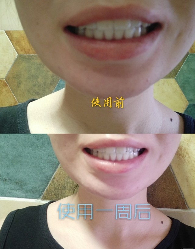 牙齿护理好物推荐pdd,牙护理测评