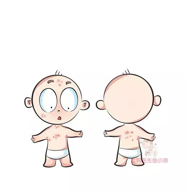 宝宝湿疹热疹小皮疹的区别,40天新生儿热疹皮疹怎么解决