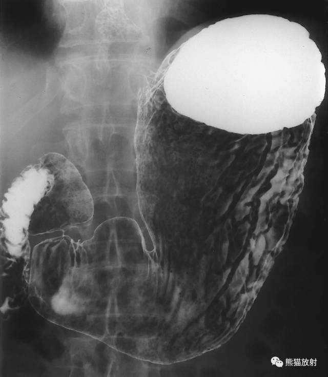 详细的消化道造影+彩色解剖图