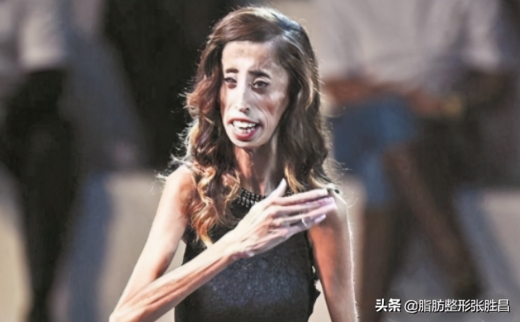 想瘦哪就瘦哪？抽脂才没那么神奇，变美要安全，请别再过度医疗了