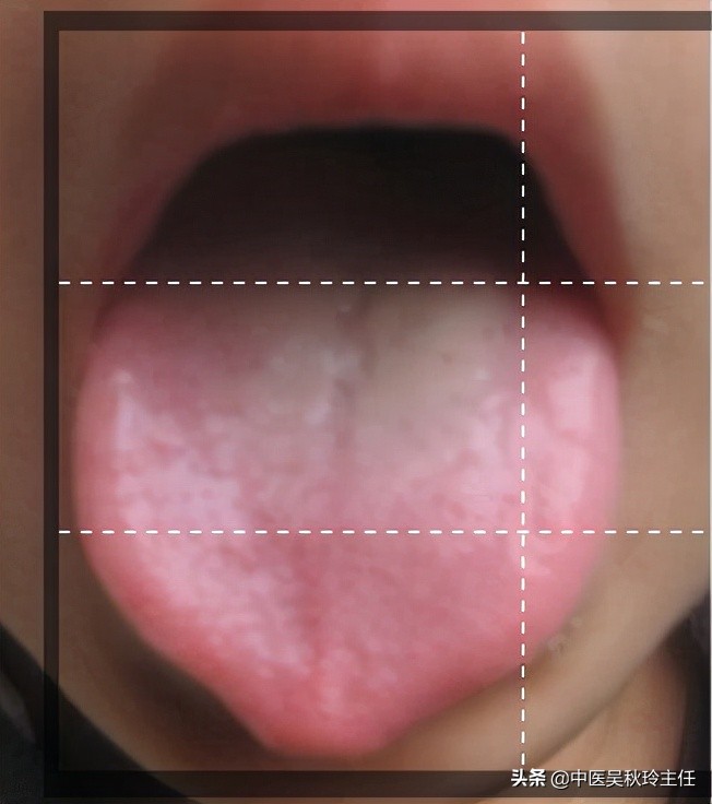 小孩厌食不吃饭该怎么办,孩子厌食不爱吃饭补锌