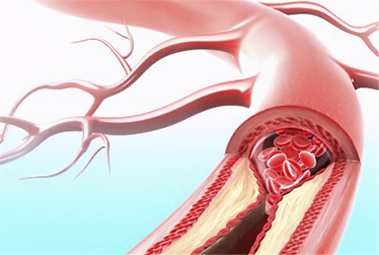 高血压人吃叶酸什么牌子好,高血压补叶酸哪种叶酸既便宜又好
