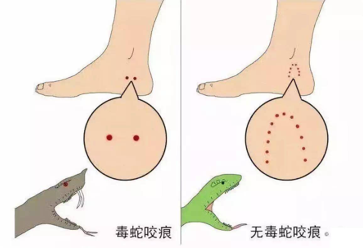 被蟒蛇吞下匕首能逃出来吗,被巨蟒吞下后有几率活下来吗