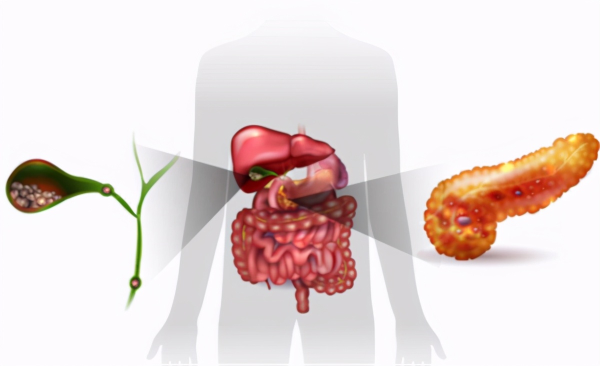 胆囊炎为啥不能吃鸡蛋,胆囊炎能吃鸡蛋和鱼吗