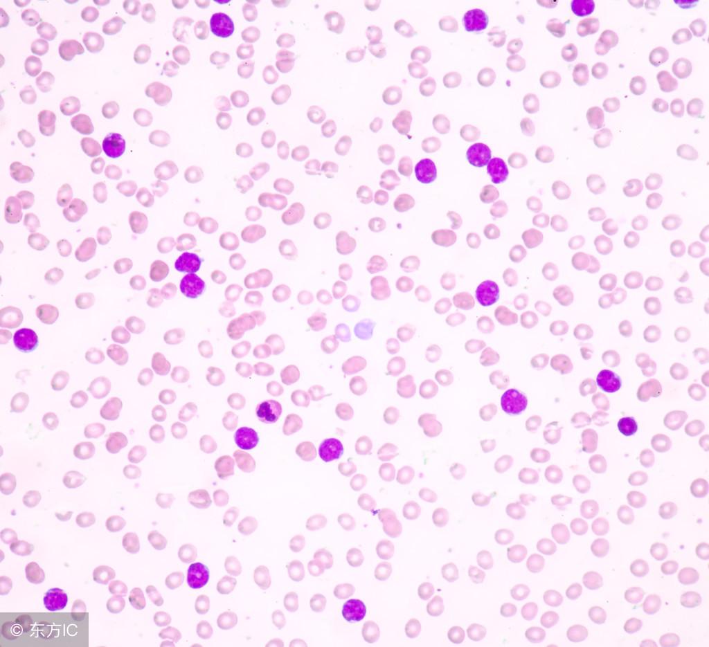 如果出现血小板减少如何用药调理,血小板减少可以输血补吗