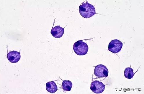 尿道炎为什么小便刺痛,小便刺痛一定是尿道炎吗