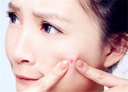 美妆美业-赵勤丨脸颊上长痘痘是什么原因，你知道吗