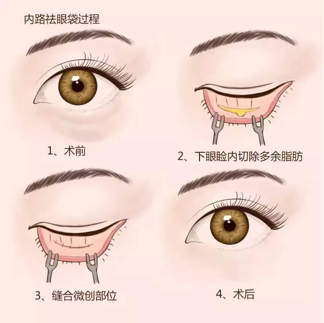 导致衰老的是哪个器官,导致衰老的原因