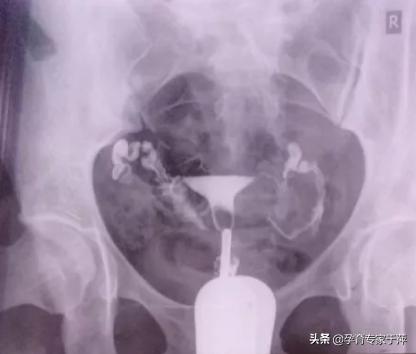 助孕专家于萍,青岛医生于萍视频