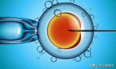 试管婴儿知识,做试管婴儿要趁早