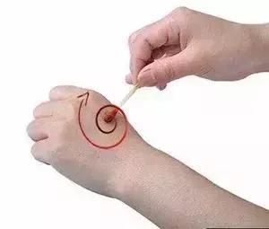 如果受伤了怎么处理才不会留疤,受伤不想留疤不能吃什么