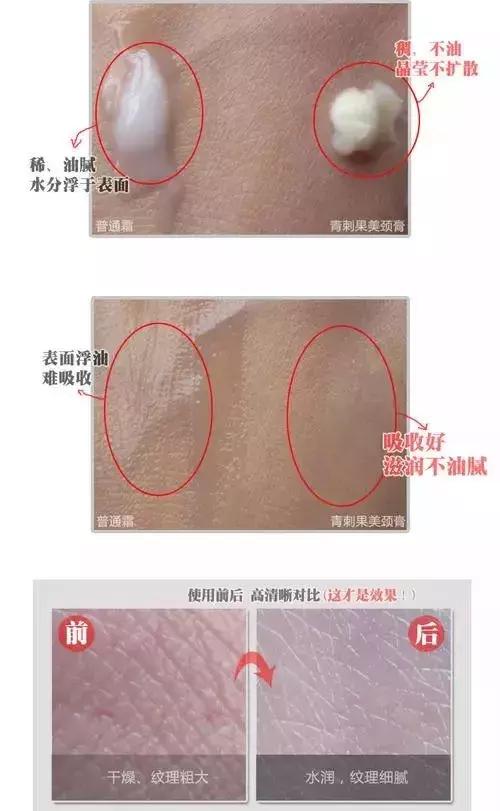 颈纹怎么运动消除简单方法,如何消除颈纹最有效的运动方法