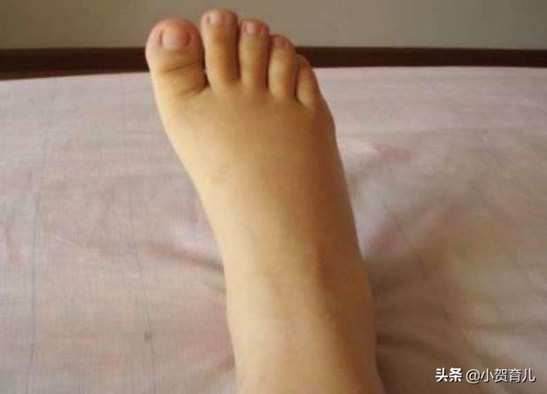 怀孕5个月注意事项及禁忌,胎儿5个半月孕妇要注意什么