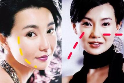 人中长颧骨高适合什么发型,人中长太阳穴凹陷