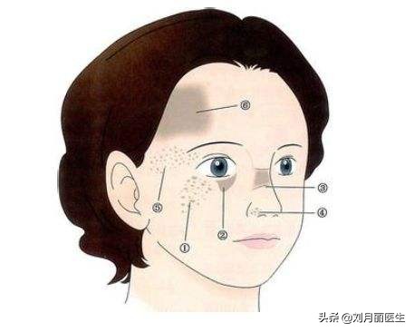治疗黑胎记最好的方法,眼部胎记太田痣激光恢复过程
