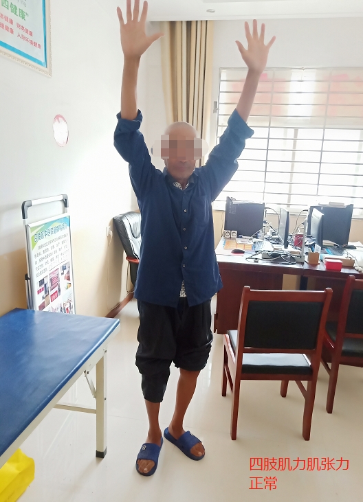 手指麻木不一定是颈椎病