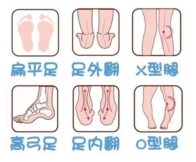 给宝宝选鞋少走弯路,怎么样挑选合适不压脚的鞋子