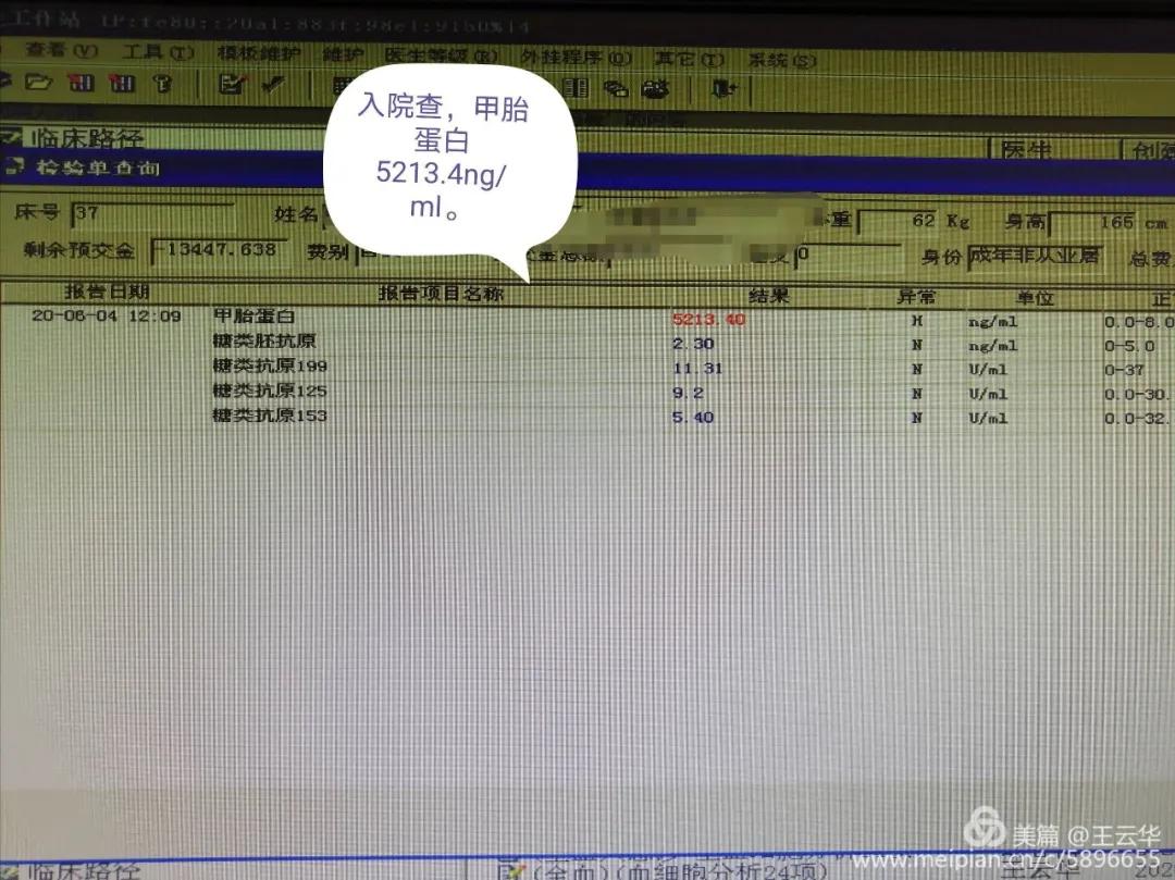 楚雄州人民医院肝胆外二科,四川省人民医院肝胆外科治疗肝癌