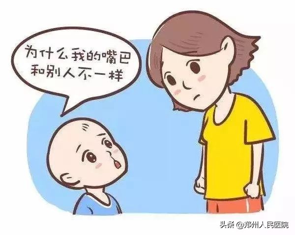 唇裂修复前后对比照,唇裂修复的全过程