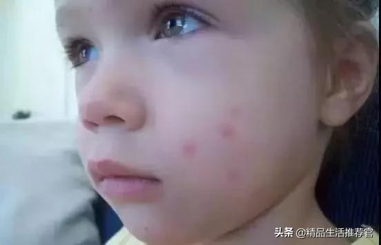 夏季再也不用担心蚊子,夏天不用药品防治蚊子的办法