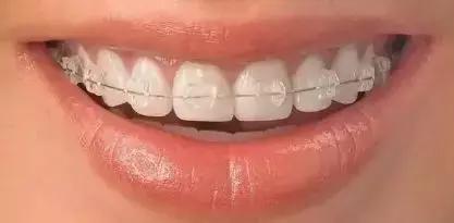 抓住暑假的尾巴来个大扫除,抓住暑期假期的小尾巴