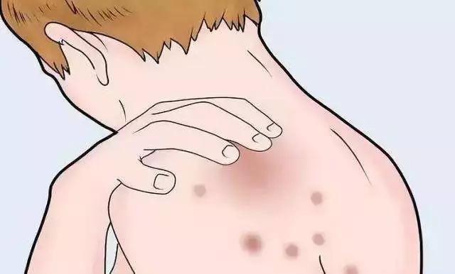 治疗皮肤痒的药膏对照大全,怎么辨别皮肤痒买哪种药膏