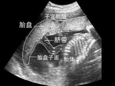 孕早期不知道怀孕了吃药了怎么办,孕早期不知道怀孕了吃药有影响吗