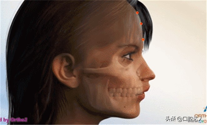 牙齿深覆合怎么判断严不严重,牙齿深覆合是什么样子