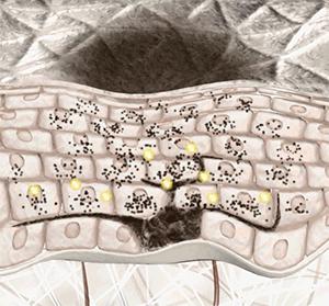 美白针是正规的吗,美白针的风险