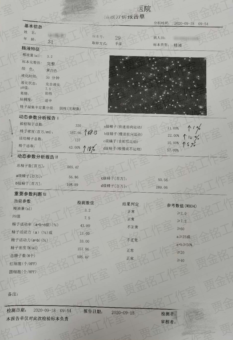 重度弱精子症还能怀孕吗,弱精子症可不可以怀孕