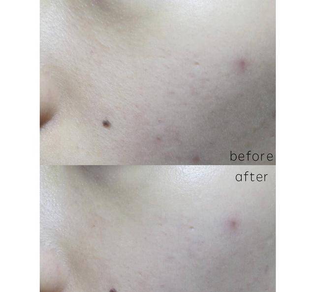 ps去雀斑最有效的小妙招,ps祛雀斑的最佳方法