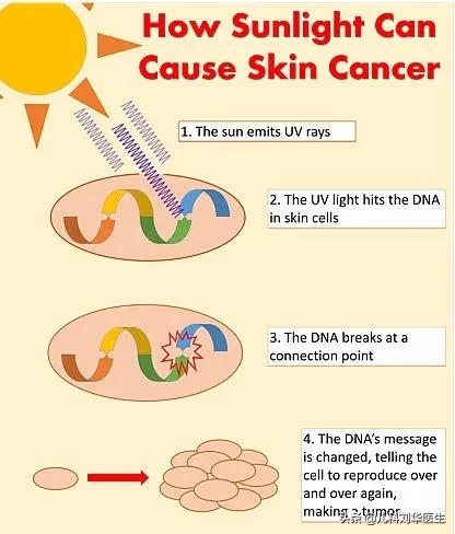 幼儿防晒小常识大全,儿童日常防晒怎么选择
