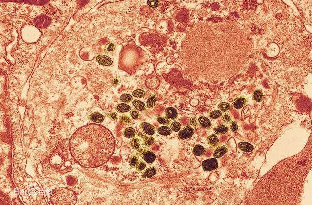 科普向——战“疫”进行时！三分钟看完世界病毒发现史！