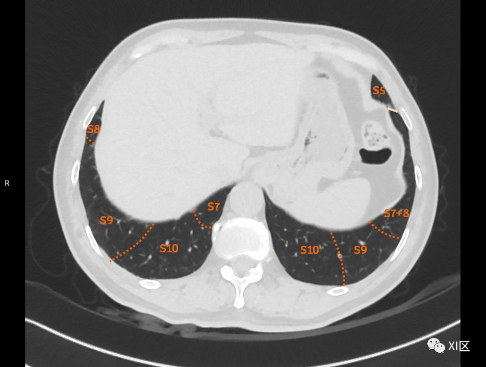 如此详细的肺部影像解剖，有点儿酷！