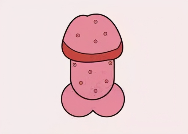 丁丁上怎么长了“小疙瘩、小红点”?难道是染上了性病?