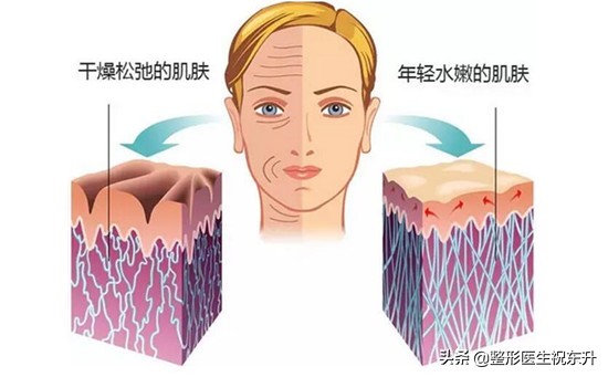 关于水光针的这几大误区，哪一条最终欺骗了你？