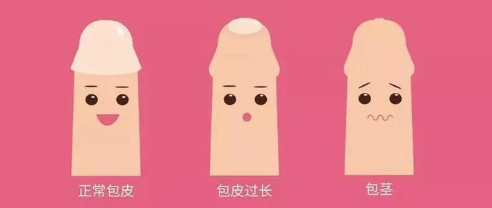 推荐|少侠，包皮割不割？