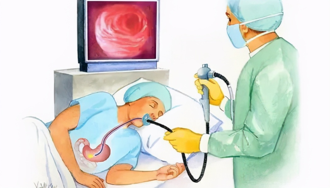 确诊胃食管反流必须要做什么检查,诊断胃食管反流