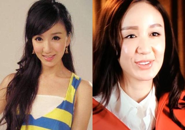 为什么打了玻尿酸脸更大了,女明星打了玻尿酸笑僵脸