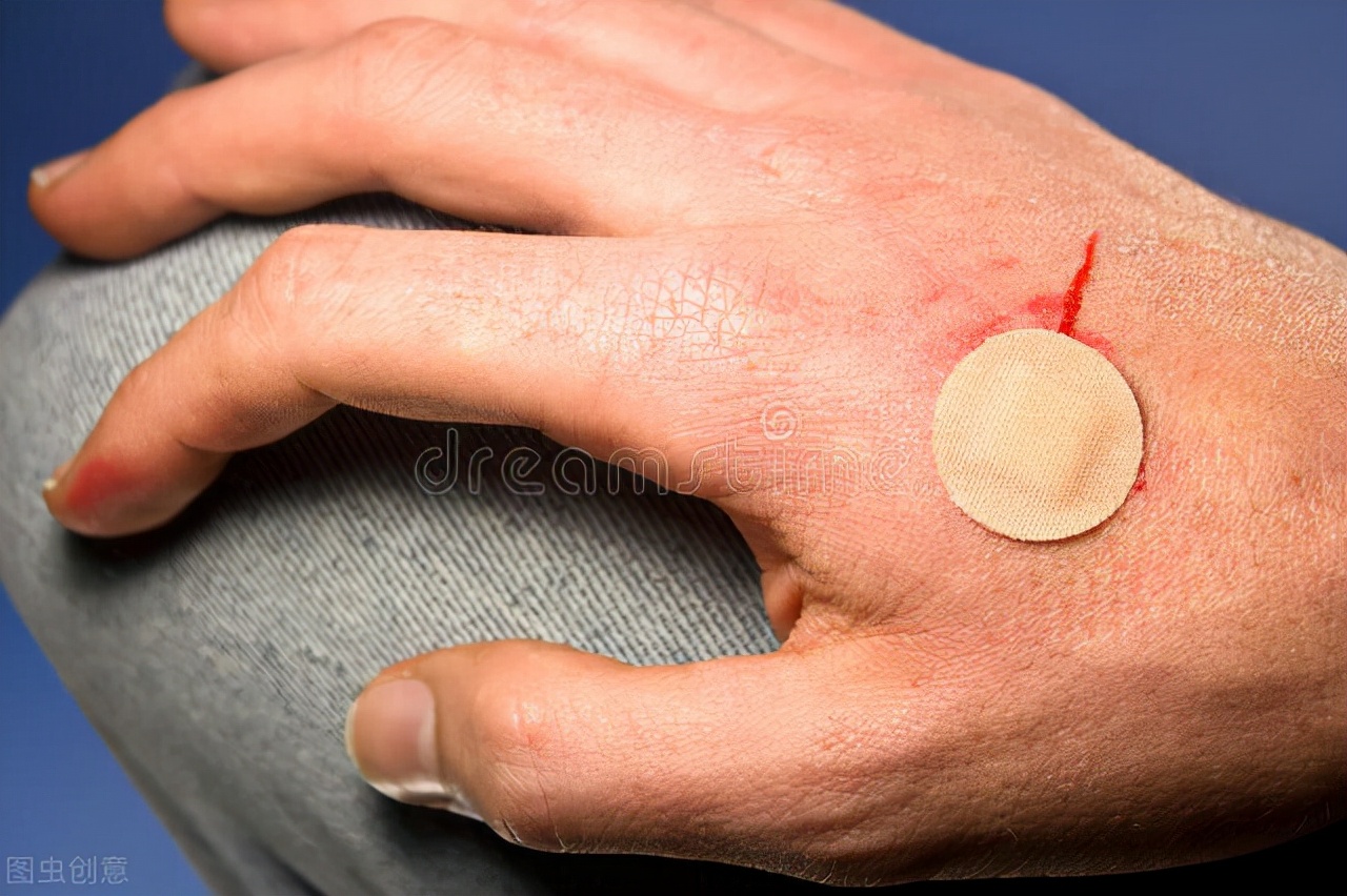 外伤出血如何清创包扎,大出血外伤急救包扎与止血的方法